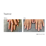 50ml Treatmist